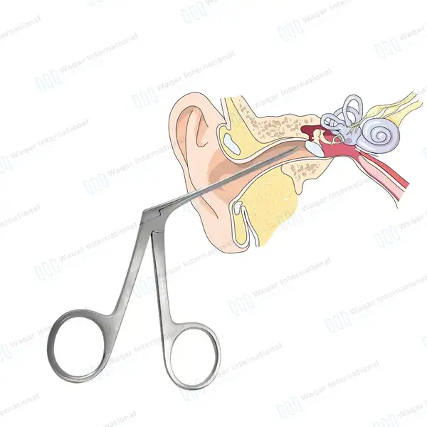 3 Hartmann Crocodile Alligator Ear Forceps 3.5″ 5.5″ & 6.5″ - surgical instruments manufactured by Waqar International, Sialkot - view 2