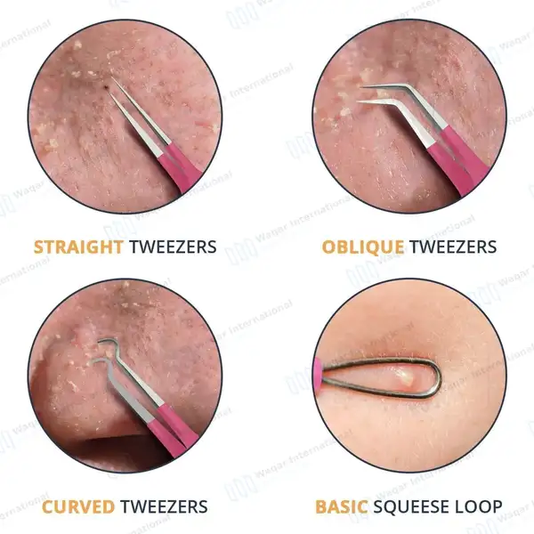 10 Pcs Blackhead Remover Pimple Popper Tools Kit – Pink - surgical instruments manufactured by Waqar International, Sialkot - view 4