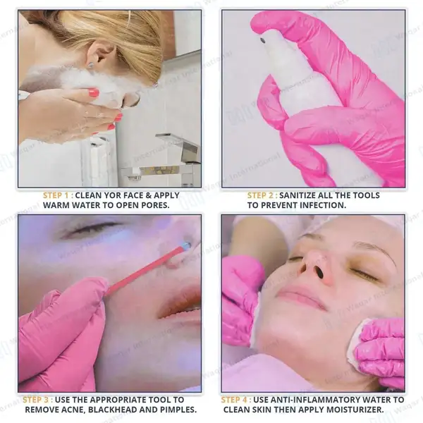 10 Pcs Blackhead Remover Pimple Popper Tools Kit – Pink - surgical instruments manufactured by Waqar International, Sialkot - view 6