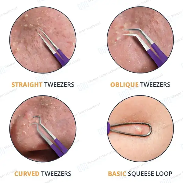 10 Pcs Blackhead Remover Pimple Popper Tools Kit – Purple - surgical instruments manufactured by Waqar International, Sialkot - view 4