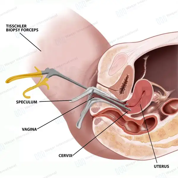 Burke Biopsy Punch 5.5mm x 3.25mm Bite Open Handle - surgical instruments manufactured by Waqar International, Sialkot - view 9