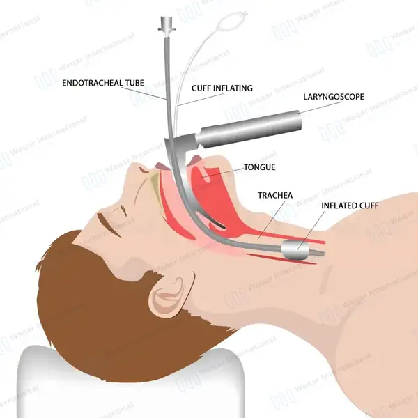 Macintosh Blade #0 with Fiber Optic Laryngoscope Medium Handle - surgical instruments manufactured by Waqar International, Sialkot - view 9