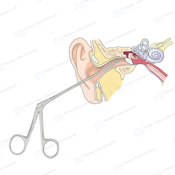7 Pcs Alligator Ear Forceps Set 3.5″, 5.5″, 6.5″, 8″, 10″, 12″, 14″ Serrated Jaws - surgical instruments manufactured by Waqar International, Sialkot - view 7