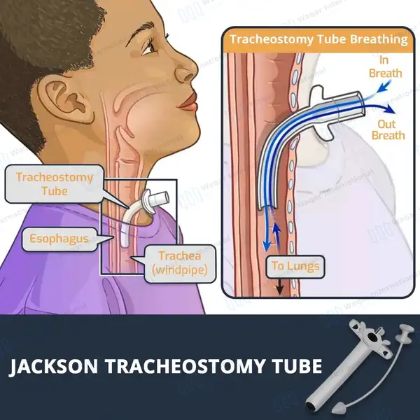 Jackson Trachea Tube Size #8 (O.D. 12mm) - surgical instruments manufactured by Waqar International, Sialkot - view 7
